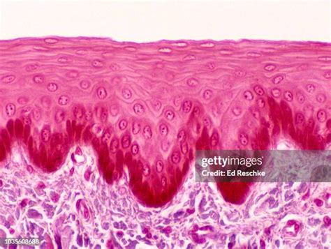 Stratified Squamous Epithelium Photos And Premium High Res Pictures