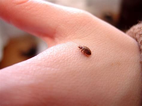 Where Do Bed Bugs Hide On Your Body Storables