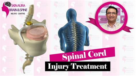 Spinal Cord Injury Treatment Dr Vikas Kathuria Best Spine Doctor