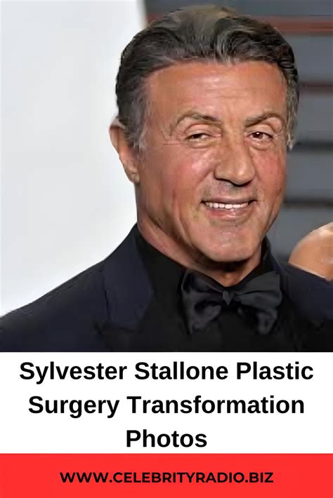 Sylvester Stallone Plastic Surgery Before and After