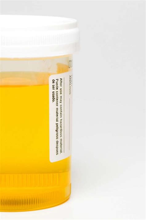 What Would Cause A Sulfur Smell In Your House - House Poster