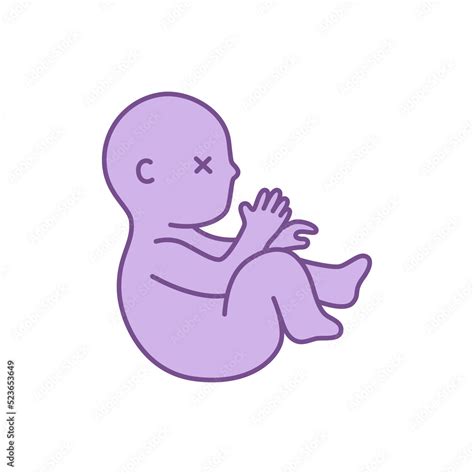 Dead Fetus Baby Vector Illustration Concept Miscarriage Pregnancy