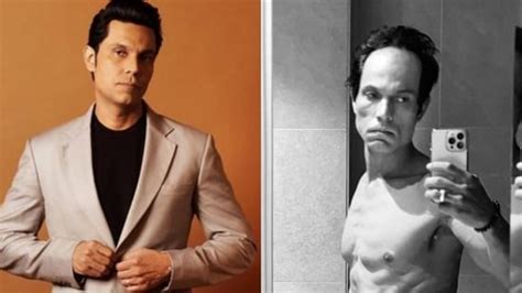 Randeep Hooda On Drastic Transformation My Body Is Revolting Against