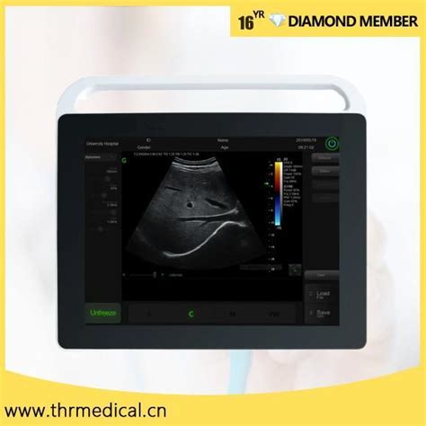 Ultrasound Diagnostic Equipment Portable Medical 15 Inches Ultrasound