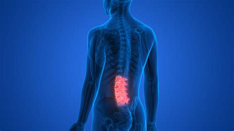 Lumbar Sympathetic Blocks And Neurolysis Restorative Pain Management