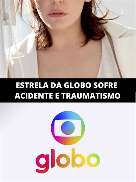 Estrela Da Globo Sofre Acidente E Traumatismo Craniano Tv Foco