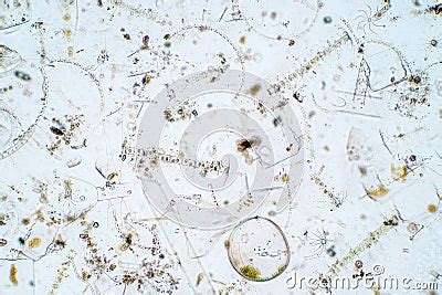 Marine Aquatic Plankton Under Microscope View Royalty-Free Stock Photo | CartoonDealer.com ...