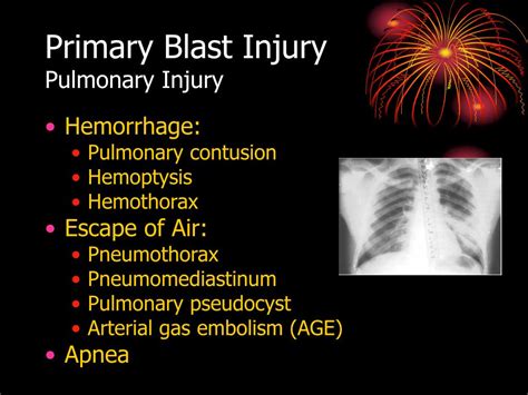 Ppt Evaluation And Treatment Of Blast Injuries Powerpoint Presentation Id 253100