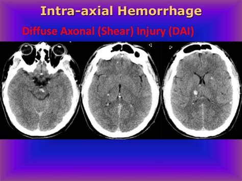 Ct And Mri Interpretation