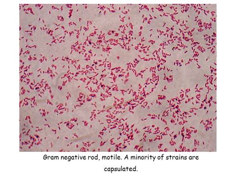 Enterobacteriaceae Microscopic Appearance Cultural Characteristics