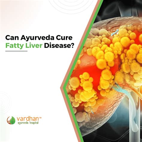 Can Ayurveda Cure Fatty Liver Disease Vardhan Ayurveda