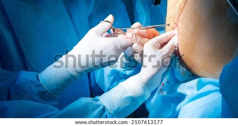 16.158 Anusitis Bilder, Stockfotos und Vektorgrafiken | Shutterstock
