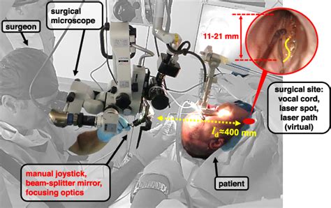 Figure 1 From Microscale Precision Control Of A Computer Assisted Transoral Laser Microsurgery