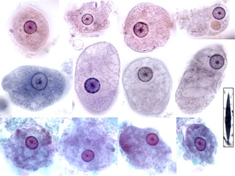 Entamoeba Histolytica Troph