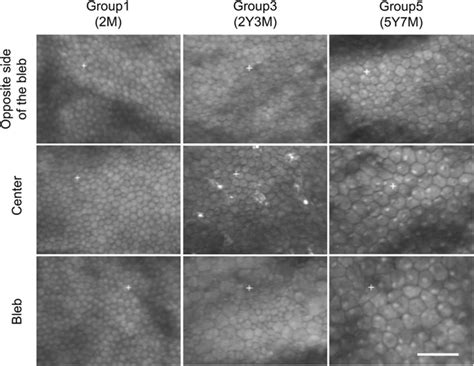 Representative Corneal Endothelial Cell Cec Images Obtained At Download Scientific Diagram