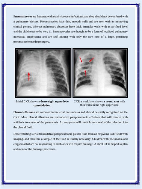 How To Read A Chest X Ray Pdf Abcde Mnemonic Step By Step Off