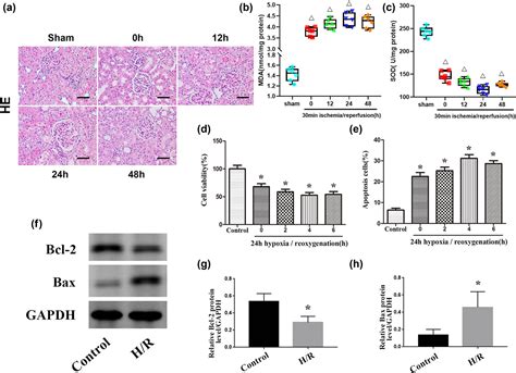 MiR 25 3p Protects Renal Tubular Epithelial Cells From Apoptosis