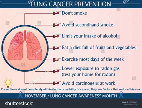 Lung Cancer Disease Prevention Infographic Vector Stock Vector (Royalty ...