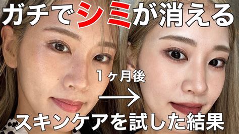 【シミ】1ヶ月でシミが消えるスキンケアを試した結果 ゼオスキン Youtube