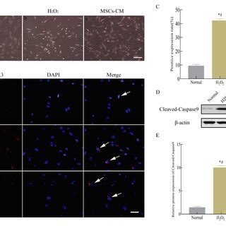 UC MSCs CM Protected HT22 Cells Against H2O2 Induced Neuronal