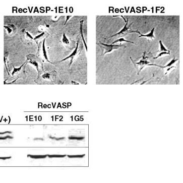 Lamellipodia Formation And VASP Expression Levels In RecVASP Cells