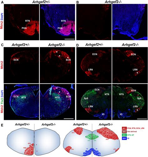 Loss Of Arhgef Affects The Formation Of Precerebellar Nuclei Of Da