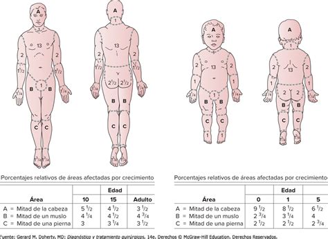 Enfermera A La Carga Regla De Wallace