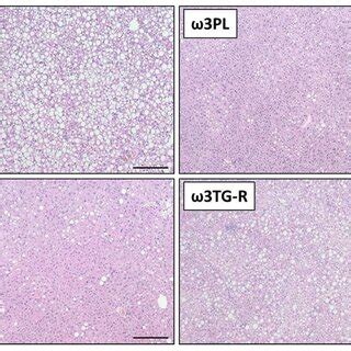 Representative Histological Sections Of Liver Stained With Hematoxylin