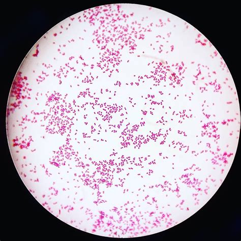 Moraxella Catarrhalis Gram Stain