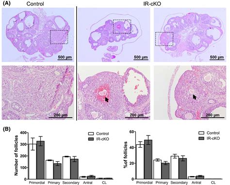 Periovulatory Insulin Signaling Is Essential For Ovulation Granulosa