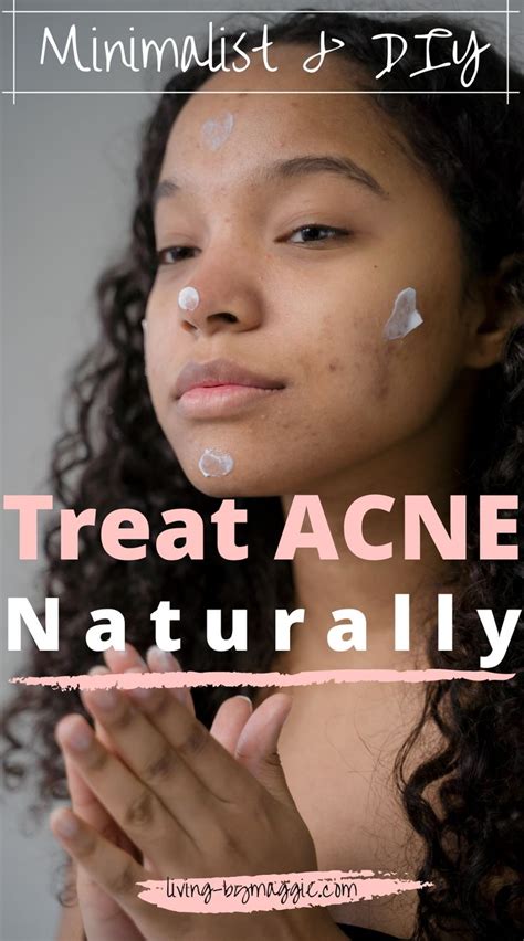 Treat Acne Naturally A Complete Routine Acne Skincare Routine How