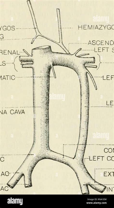 Inferior Vena Cava Branches