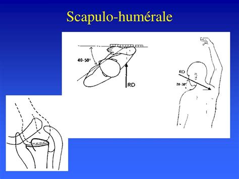 PPT Advanced Radiographic Techniques For Spinal Imaging PowerPoint