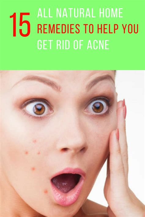 15 All Natural Home Remedies For Acne That Really Work How To Get Rid