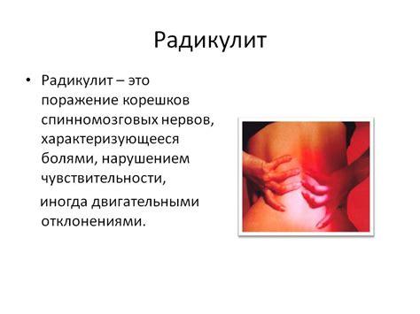 Как лечить радикулит? Радикулит и остеохондроз. Радикулит поясничный ...