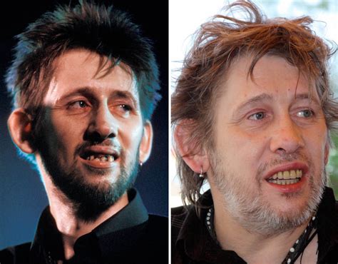 The Pogues singer Shane MacGowan shows off his teeth transformation ...