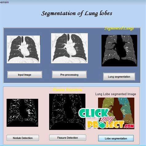 Automatic Segmentation Of The Pulmonary Lobes From Chest Ct Scans Based On Fissures Vessels And