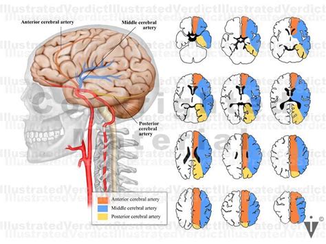 Stock Brain Normal Anatomy Vasculature — Illustrated Verdict