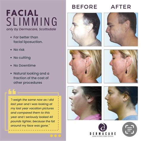 Dermacare Non Surgical Face Body Sculpting Photos Reviews