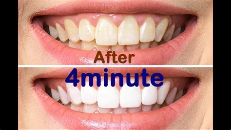 Pearly White Teeth At Home In 4 Minutes How To Whiten Your Teeth