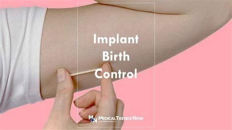 Implant Birth Control In The Philippines: Price, Removal, Pros and Cons ...