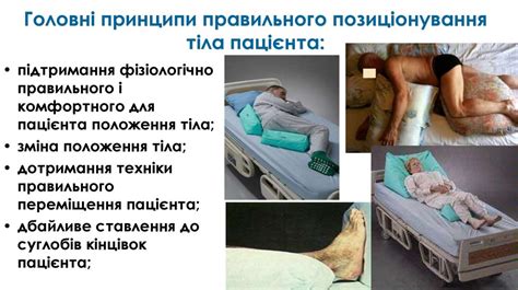 Пролежні та трофічні ураження шкіри у паліативних пацієнтів: сучасні ...