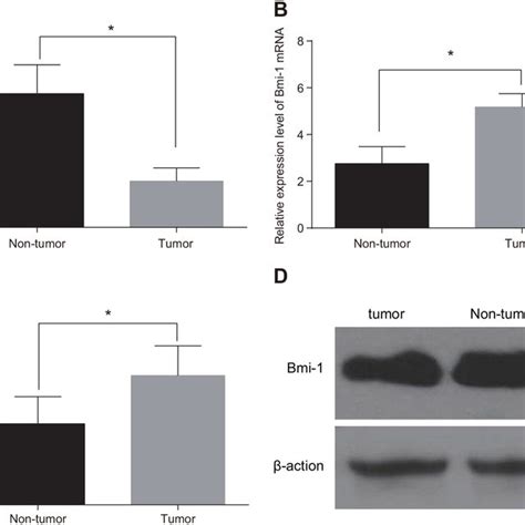 Comparison Of Mir 132 And Bmi 1 Expression In Tumor And Adjacent Normal