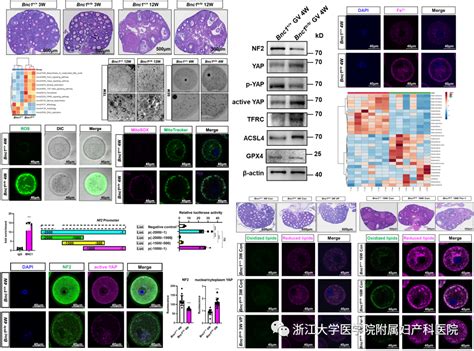 “卵巢功能不全”和基因有关吗？张丹教授团队的研究成果，登上nature子刊！ 卵巢功能 死亡 卵母细胞 研究 团队 健康界