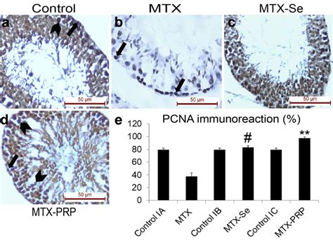 Pcna Immunohistochemical Nuclear Staining Of The Spermatogenic Cells