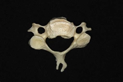 Superior View of C3 Vertebra | Neuroanatomy | The Neurosurgical Atlas