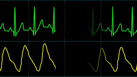 EKG Display Monitor :: Behance