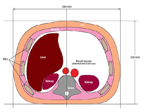 Interventional D Abdominal Phantom Multi Modality Ct Mri