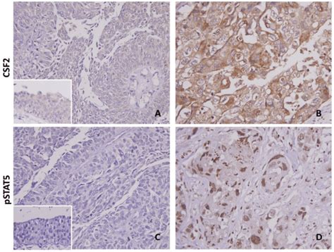 Both CSF2 And PSTAT5 Immunostaining On Representative Sections Of