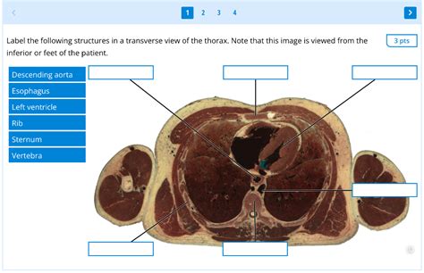 Solved Label The Following Structures In A Coronal View Of